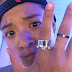 Got ring tan problems like f(x)'s Amber?