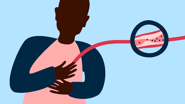 Recognizing The Signs Of A Heart Attack: A Lifesaving Guide