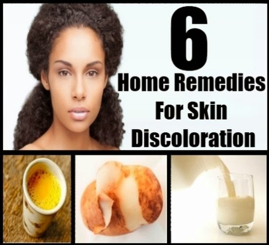 Home-Remedies-For-Skin-Discoloration-And-Dark-Skin.jpg