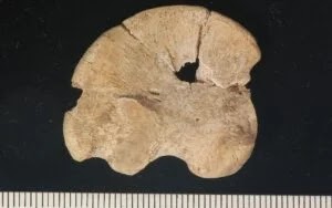 Το ίλιο -άνω μέρος του ισχυακού οστού- του νεογέννητου του Τάφου Ι. Κλίμακα σε mm. [Credit: Bartsiokas et al., Journal of Archaeological Science: Reports (2023)]