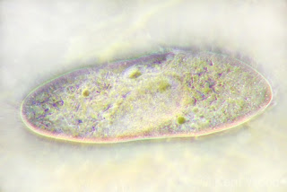 Mikroba dalam Rumen