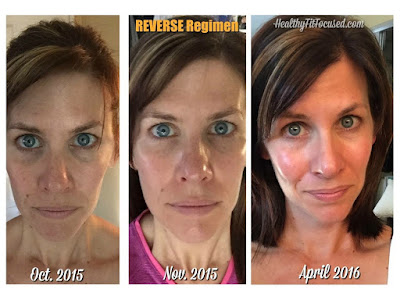 Rodan + Fields Reverse Regimen Results, Julie Little, Anti-aging Skin Care, Reverse sun damage and brown spots