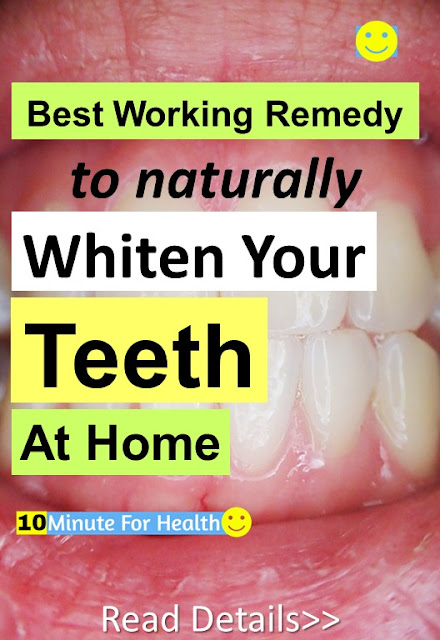 How to get white teeth at home, How to whiten teeth, teeth whitening home remedies, whiten your teeth in 5 minutes, how to get rid of yellow teeth, fast teeth whitening remedies