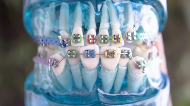 the main goals of orthodontic treatment