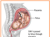 MENSTRUASI - PREGNANSI