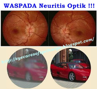 http://eyecaresoftgelharga.blogspot.com/