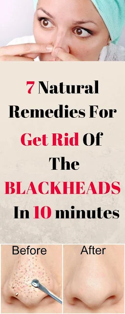 7 Natural Remedies For Blackheads That Take 10 Minutes Or Less