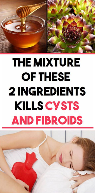Fibroids And Cysts Disappear Naturally Medicine That Helped Many Women Around The World!