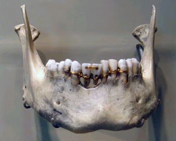 Sheva Apelbaum Ancient Egyptian Dental Work