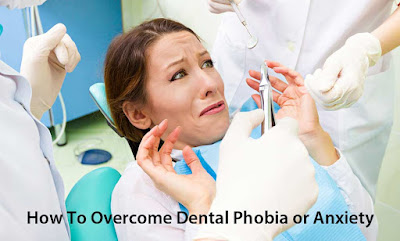 How To Overcome Dental Phobia or Anxiety