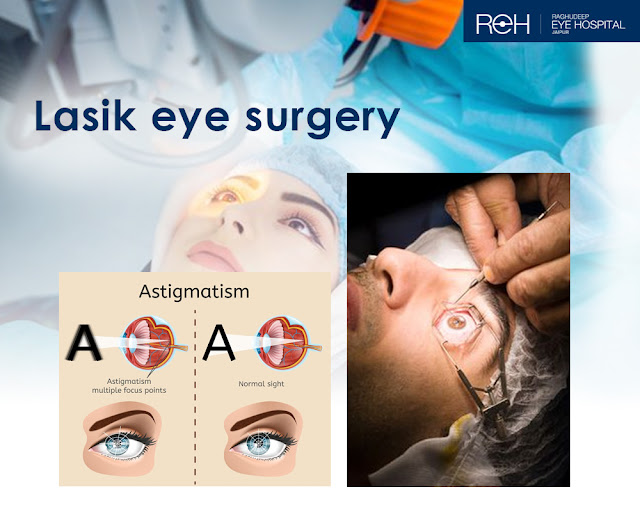 Lasik Eye Surgery Near Me