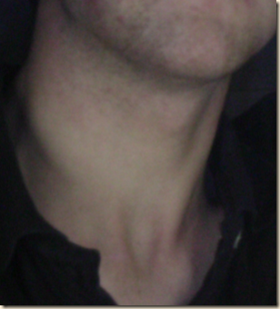 Neck