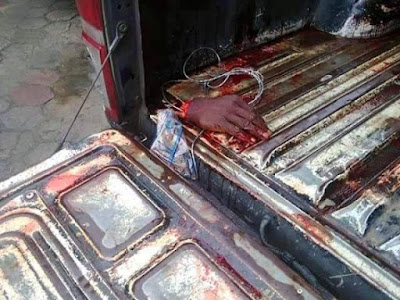 Man gets his hands chopped off while allegedly trying to steal a TV in Akwa Ibom (GRAPHIC PICs)