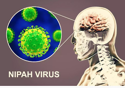 أعراض فيروس نيباه الجديد  Nipah virus