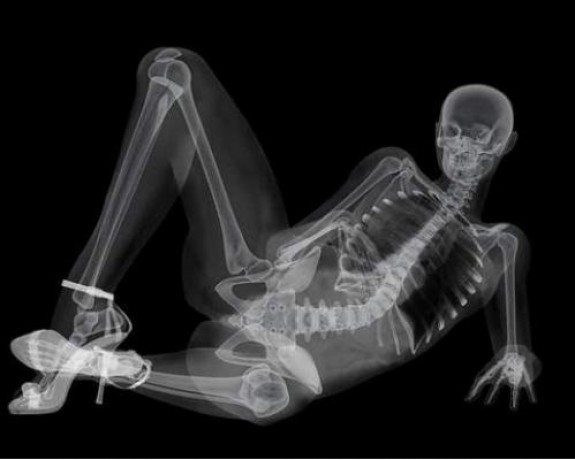 3d X ray6