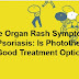 Male Organ Rash Symptoms and Psoriasis: Is Phototherapy a Good Treatment Option?