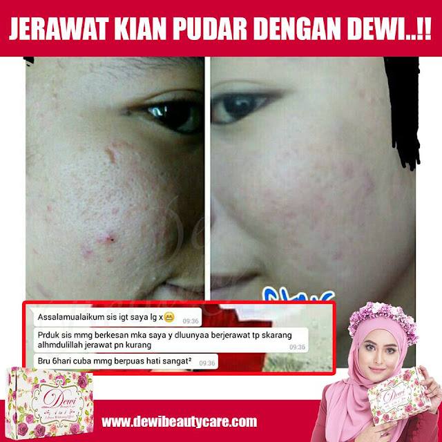 Dewi Beauty Care Skincare Murah