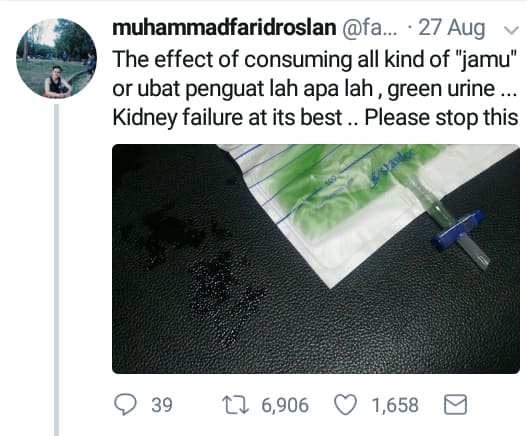 'Nak berjalan tak boleh, kalah orang dalam pantang, sakit 