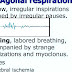 Agonal respiration