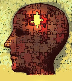How are the encephalon as well as retention impacted past times Alzheimer How Alzheimer's as well as Dementia Impact Memory as well as the Brain