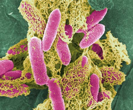 ABC of E. coli, the bacterium that scares the world