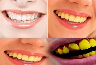 Cari Cara Mengobati Sakit Gigi Pada Anak Usia 2, 3, & 4 Tahun, Tips Kesehatan, Tips Kesehatan