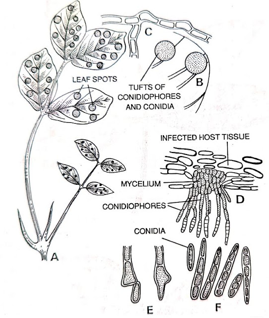 Tikka disease of groundnut