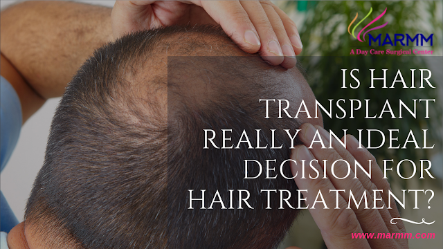 Hair transplant in Indore, Hair transplant in Bhopal, Hair doctor in Indore