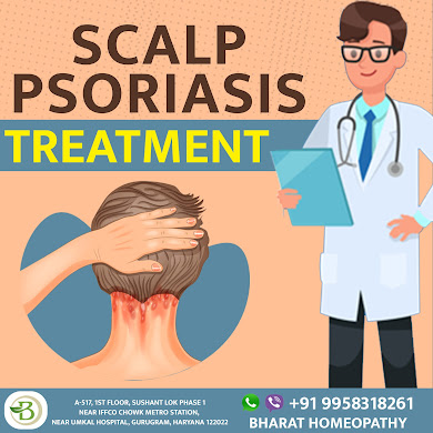 Scalp Psoriasis Treatment