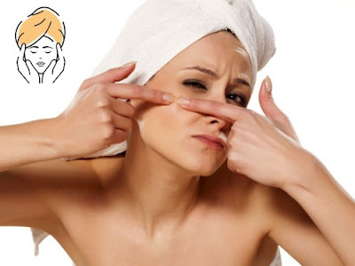 How Do You Get Rid of Pimples without Medicine