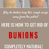 Why Do Doctors Keep This Simple Recipe Away From The Public? Here’s How To Get Rid Of Bunions Completely Natural!