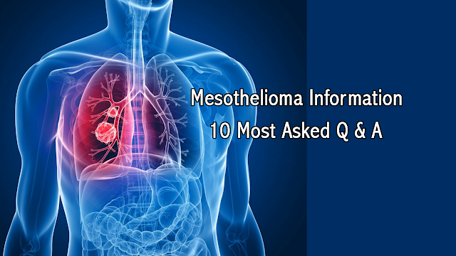  Mesothelioma Information - 10 Most Asked Q & A