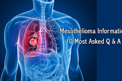  Mesothelioma Information - 10 Most Asked Q & A