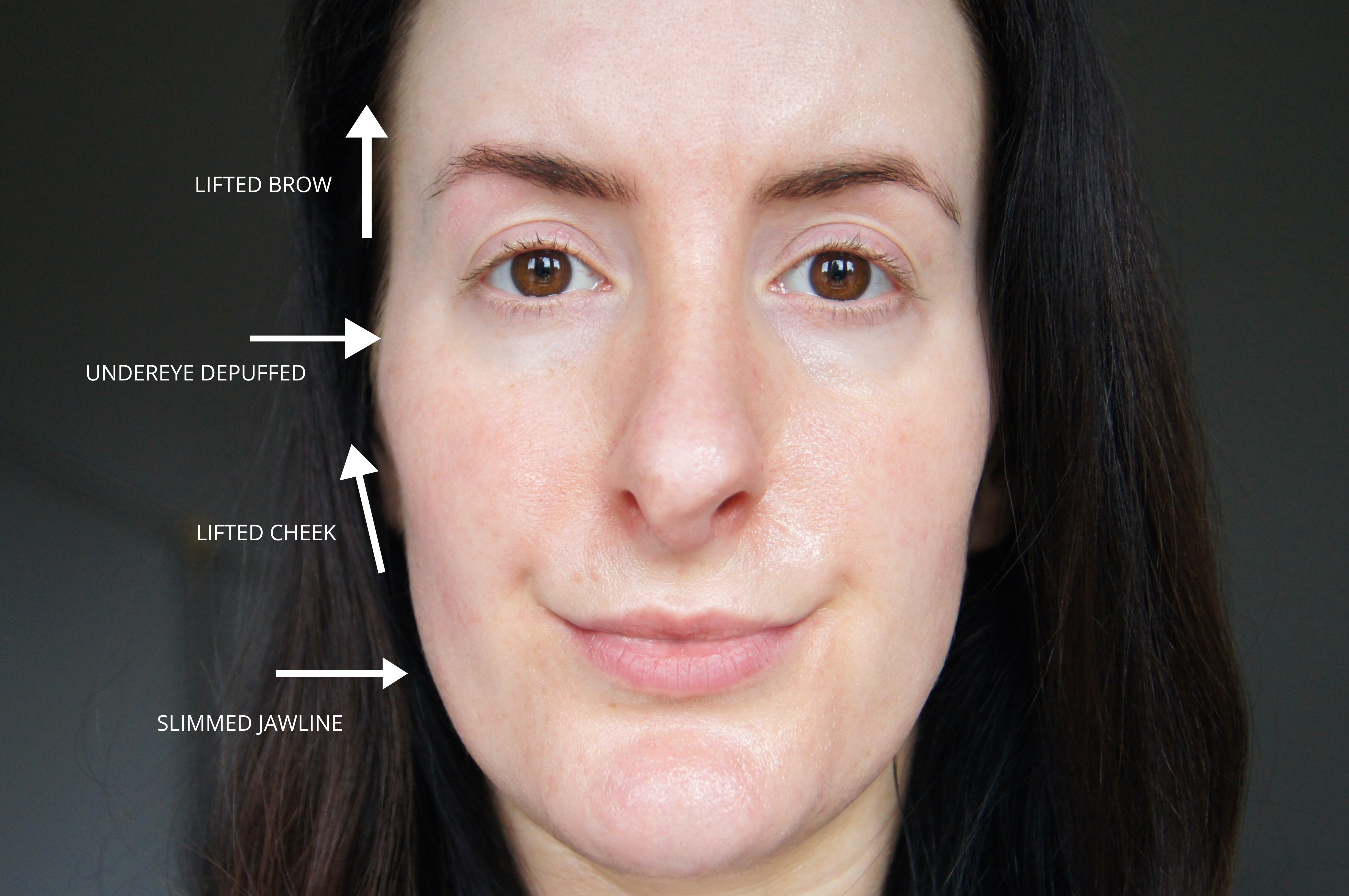 ZIIP HALO Nanocurrent Microcurrent Facial Toning Device Review Immediate Before After Results