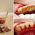 REMOVE TOOTH PLAQUE TARTAR AND BLEEDING GUMS EASILY!