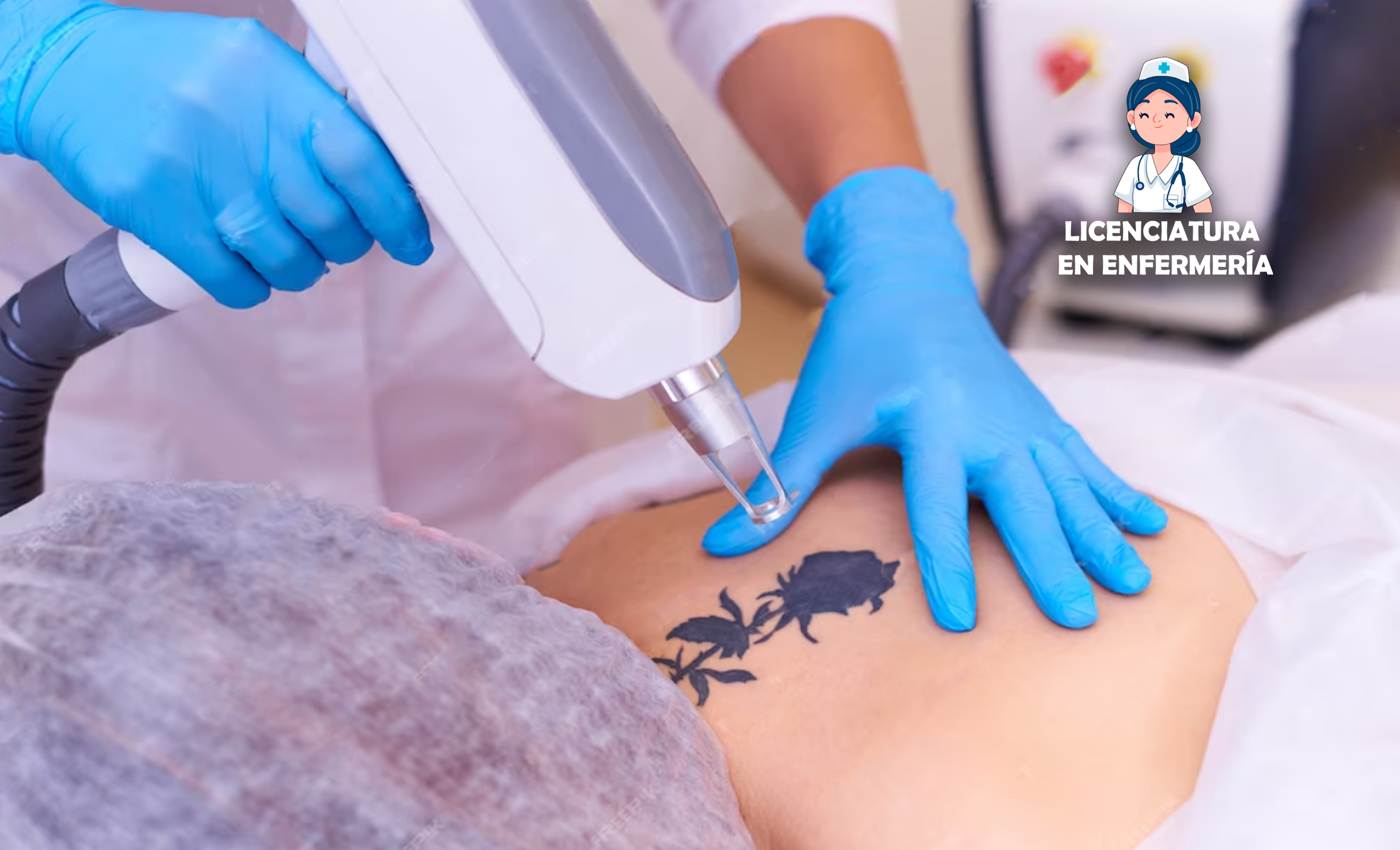 Cómo es la eliminación de tatuajes con láser