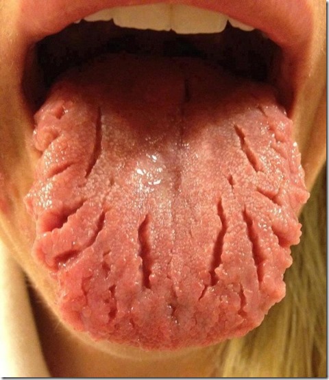  lengua geográfica FOTOS BUSCOIMAGENES COM (7)