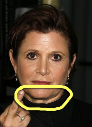 Next time get the neck lift too Carrie Carrie Fisher
