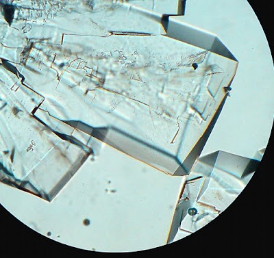 sugar crystals. Magnification -100 Times