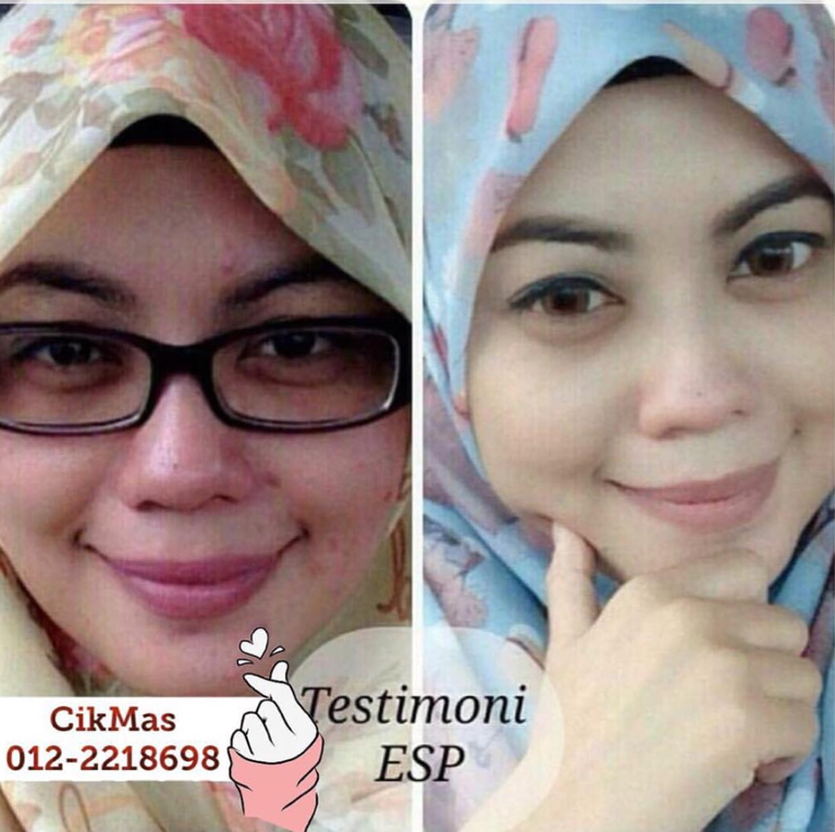 testimoni esp shaklee