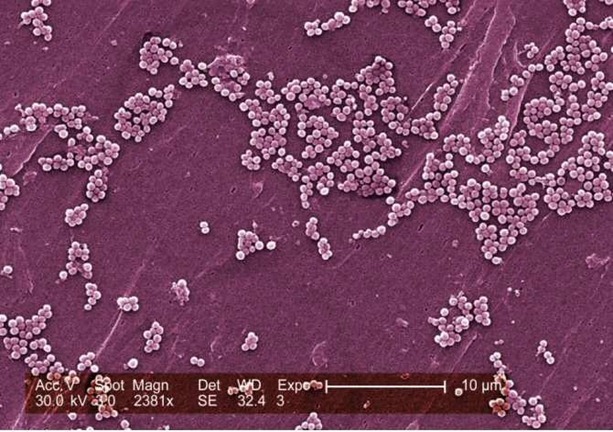 microbios 2
