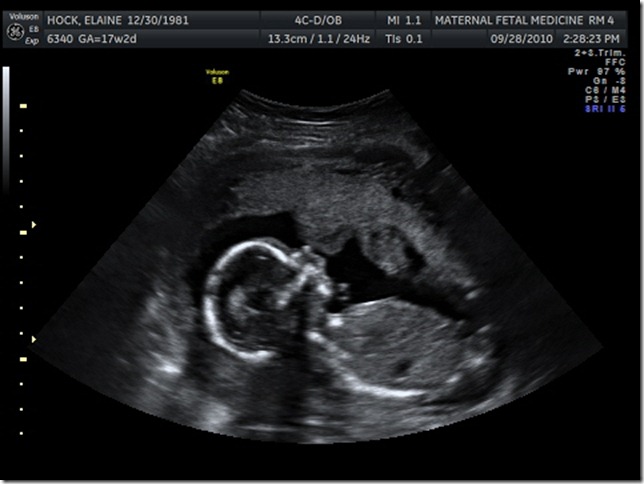 BABY 09282010_8