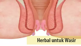 list obat ambeien paling ampuh di apotik