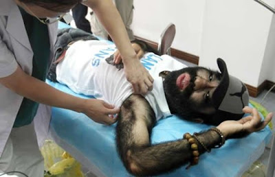 Hairiest Chinese Man Decides to Remove his Hair