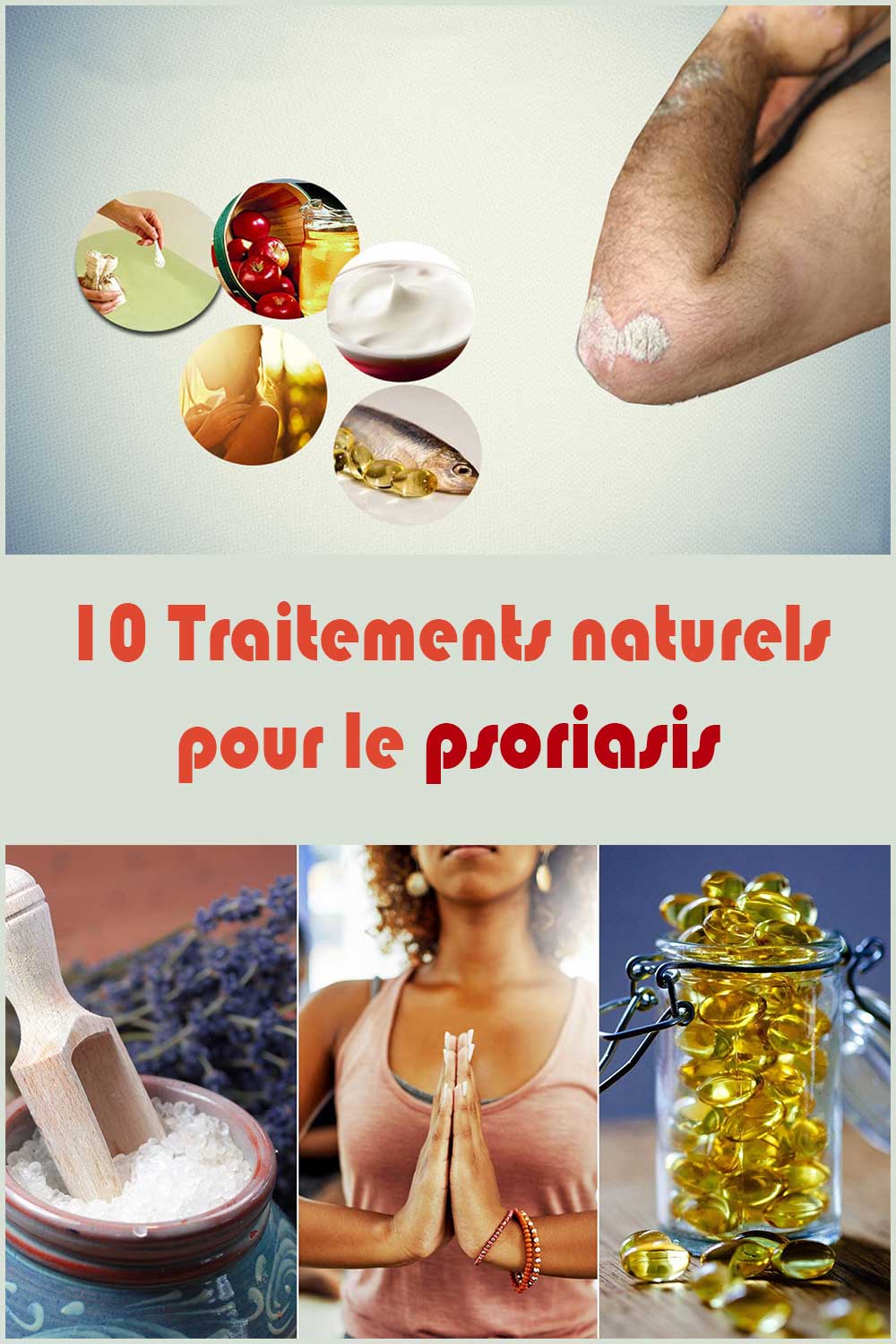 10 Traitements naturels pour le psoriasis
