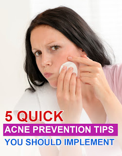 5 Quick Acne Prevention Tips You Should Implement