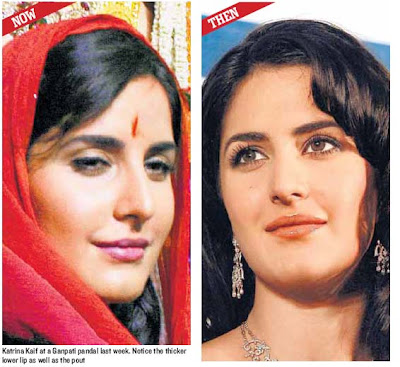 Katrina Kaif before and after lip surgery