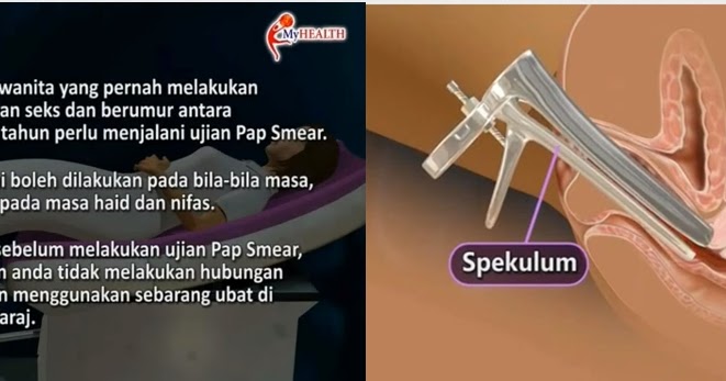 Amalini's diary: Pap Smear. Dah Buat Belum?