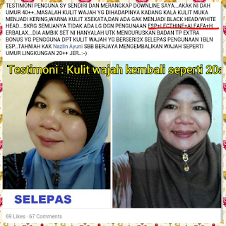 Kurus dan cantik dengan cepat dan selamat