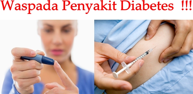 Pengobatan Alternatif Diabetes Tradisional